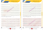 دانلود کتاب تفسیر الکتروکاردیوگرام کسری قادری 351 صفحه PDF 📘-1