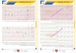 دانلود کتاب تفسیر الکتروکاردیوگرام کسری قادری 351 صفحه PDF 📘-1