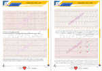 دانلود کتاب تفسیر الکتروکاردیوگرام کسری قادری 351 صفحه PDF 📘-1