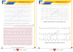 دانلود کتاب تفسیر الکتروکاردیوگرام کسری قادری 351 صفحه PDF 📘-1