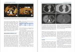 دانلود کتاب Fundamentals of Hernia Radiology سالواتور دوکیمو 414 صفحه PDF 📘-1