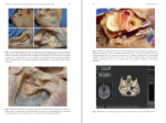 دانلود کتاب Brain Anatomy and Neurosurgical Approaches ابروال گادلها 594 صفحه PDF 📘-1